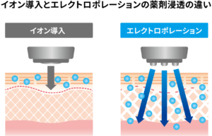 イオン導入とエレクトロポレーションの浸透の違い