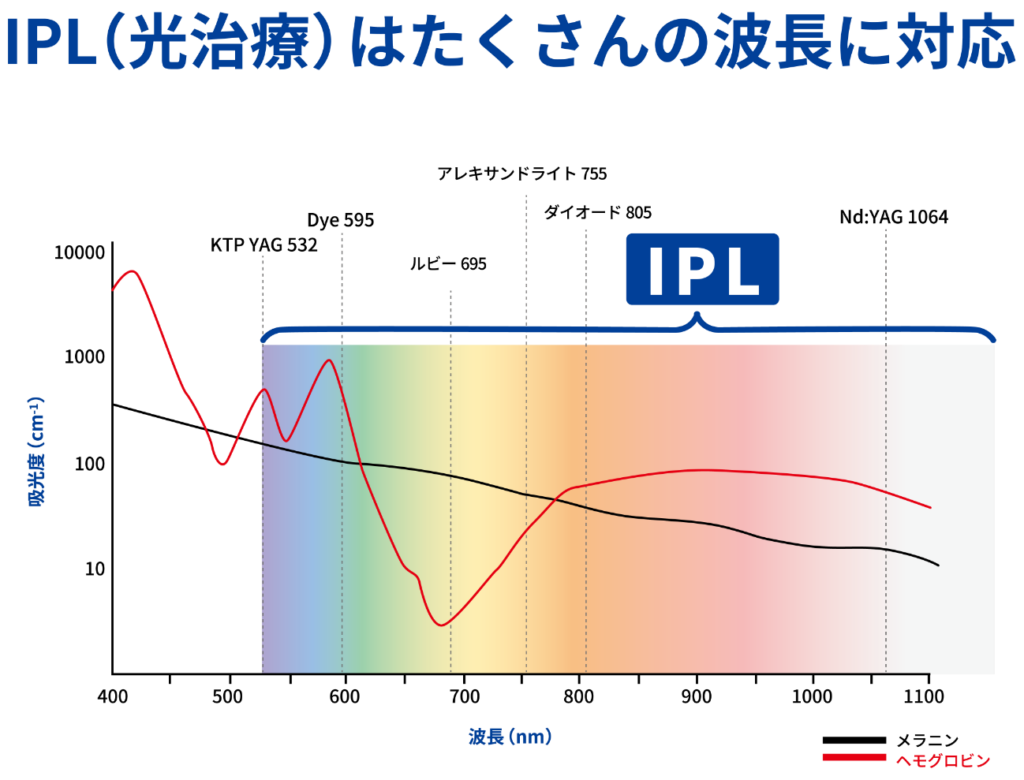 IPLの波長を示す図