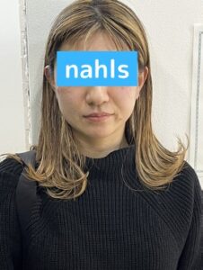 シミ体験者の写真