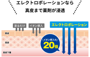 エレクトロポレーション