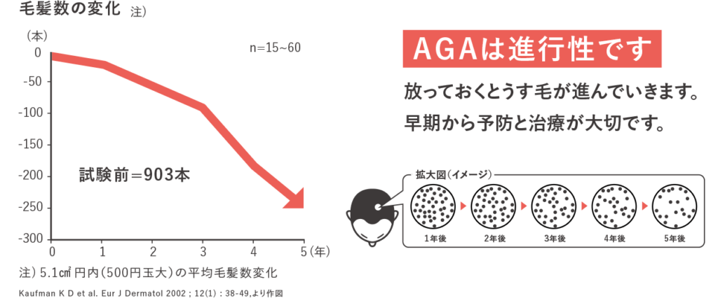 AGAの進行