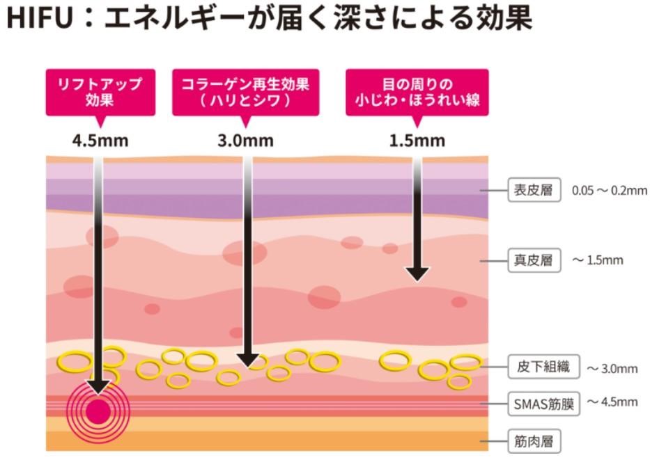 エネルギーが届く深さによる効果