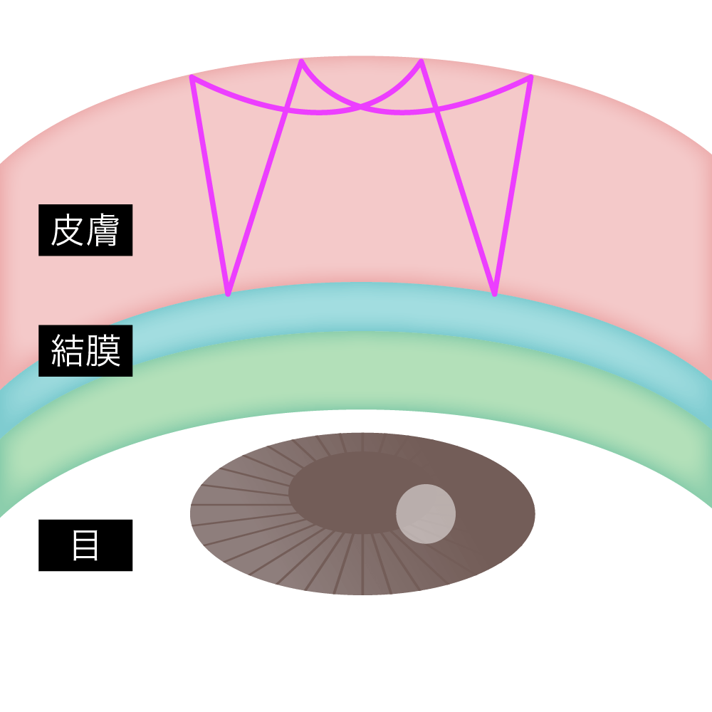 フローラループ