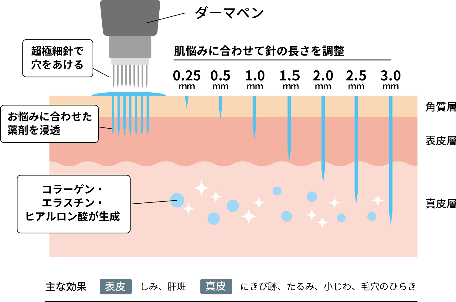 ダ―マペンの針の長さによる効果