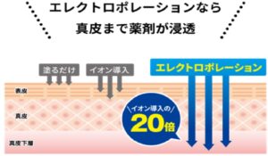 エレクトロポレーション