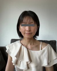橋爪さんの施術後1週間の写真