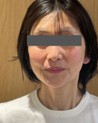 橋爪さんの施術後の写真