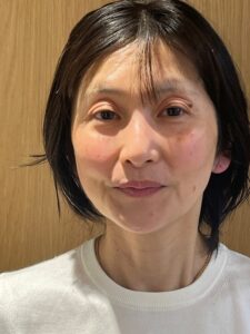 橋爪さんの施術後の写真