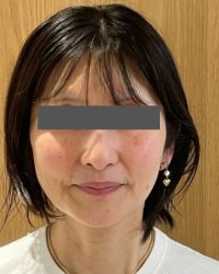 橋爪さんの施術前の写真