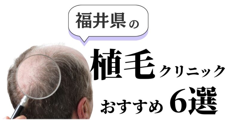 福井でおすすめの植毛クリニック8選！上手くてお徳なのは？のアイキャッチ
