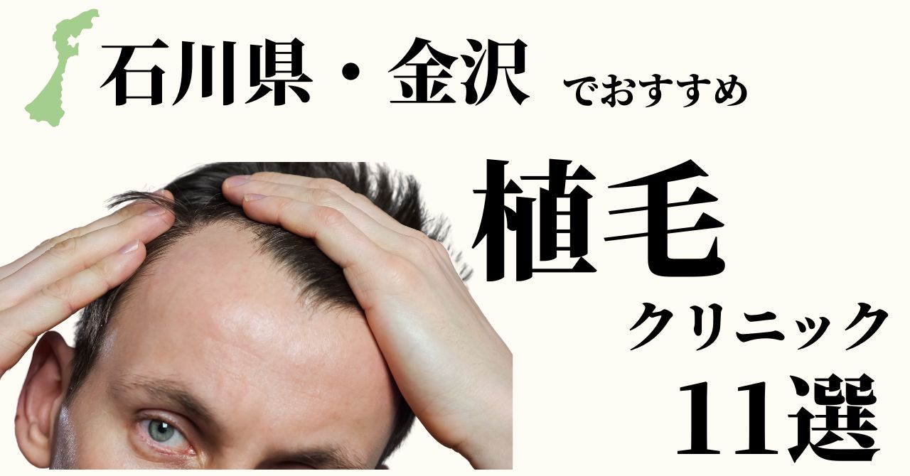 Dr.今川の植毛体験記 専門医が自分の髪で実践したドキュメント 最先端の自毛植… Dr.今川の植毛体験記 専門医が自分の髪で実践したドキュメント 最