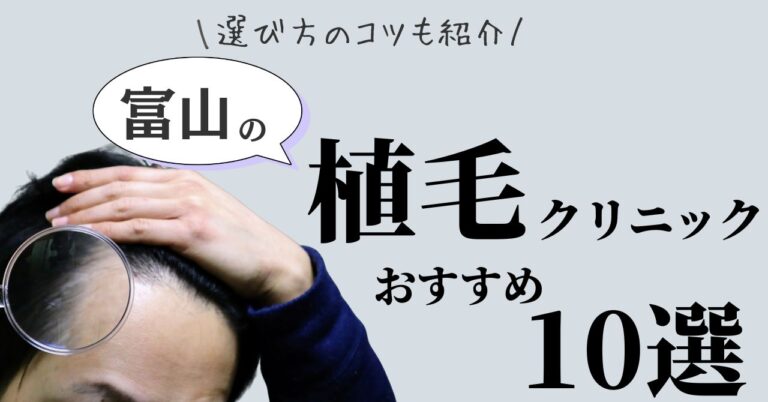 富山県でおすすめの植毛クリニック10選ご紹介＆選ぶコツ！のアイキャッチ