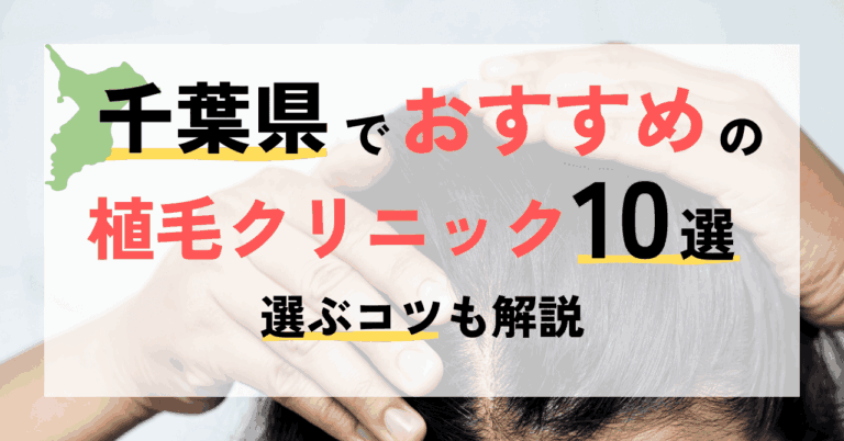 千葉県でおすすめの植毛クリニック10選！選ぶコツも解説