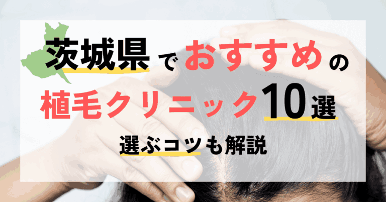 茨城県でおすすめの植毛クリニック10選ご紹介＆選ぶコツ！