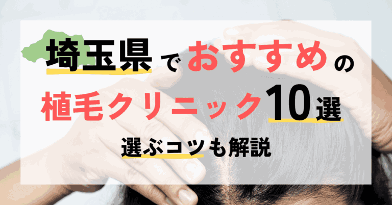 埼玉でおすすめの植毛クリニック10選ご紹介＆選ぶコツ！