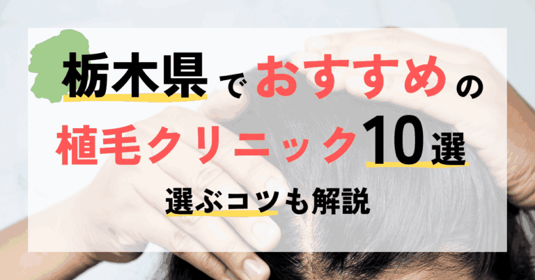 栃木県でおすすめの植毛クリニック10選ご紹介＆選ぶコツ！