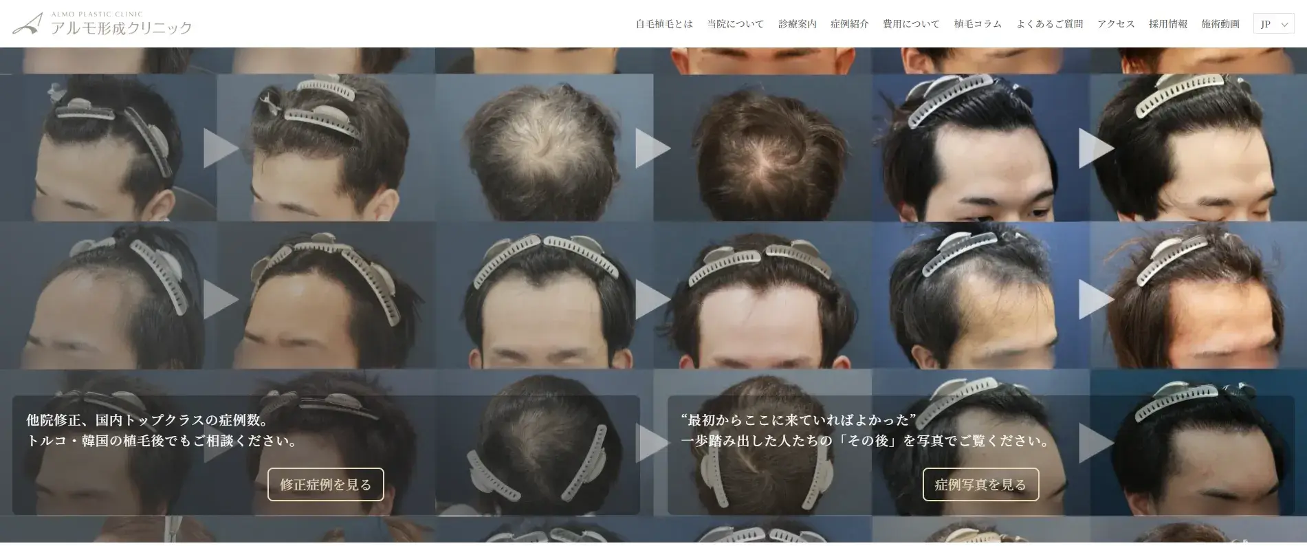 アルモ形成クリニックのホームページ画像