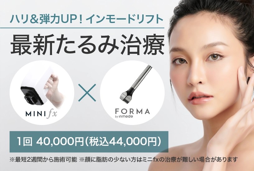 かずさ形成スキンクリニックのインモード