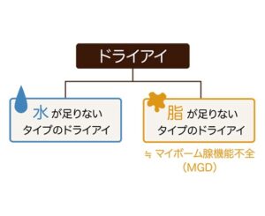 ドライアイの分類