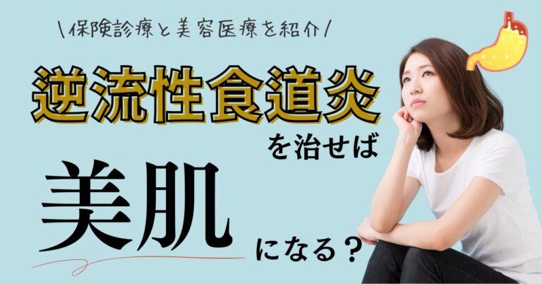 逆流性食道炎を治せば美肌になる？保険診療と美容医療を紹介【専門医監修】のアイキャッチ