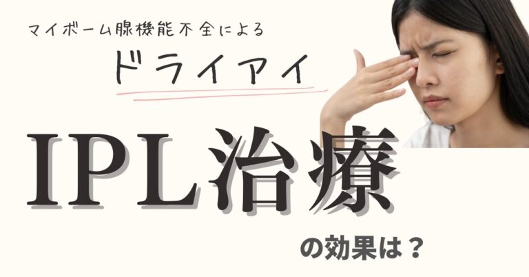 マイボーム腺機能不全(MGD)によるドライアイのIPL治療の効果は？のアイキャッチ