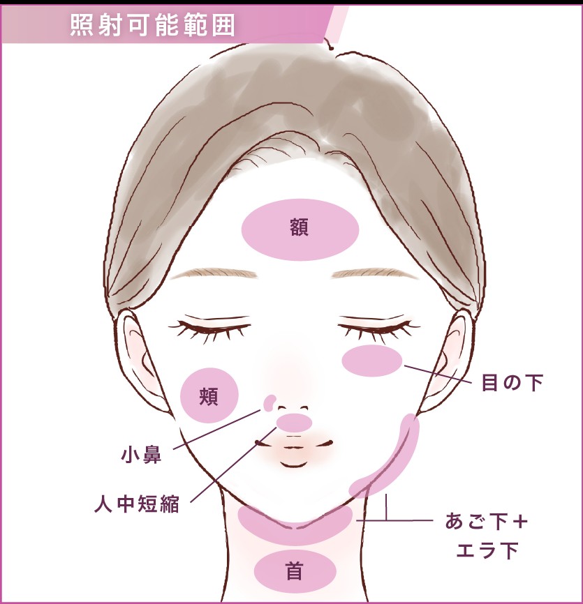 オリジオKISSの施術範囲