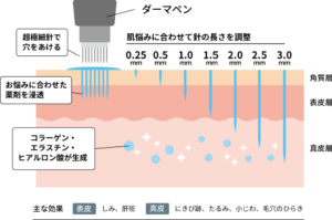ダーマペンの仕組み