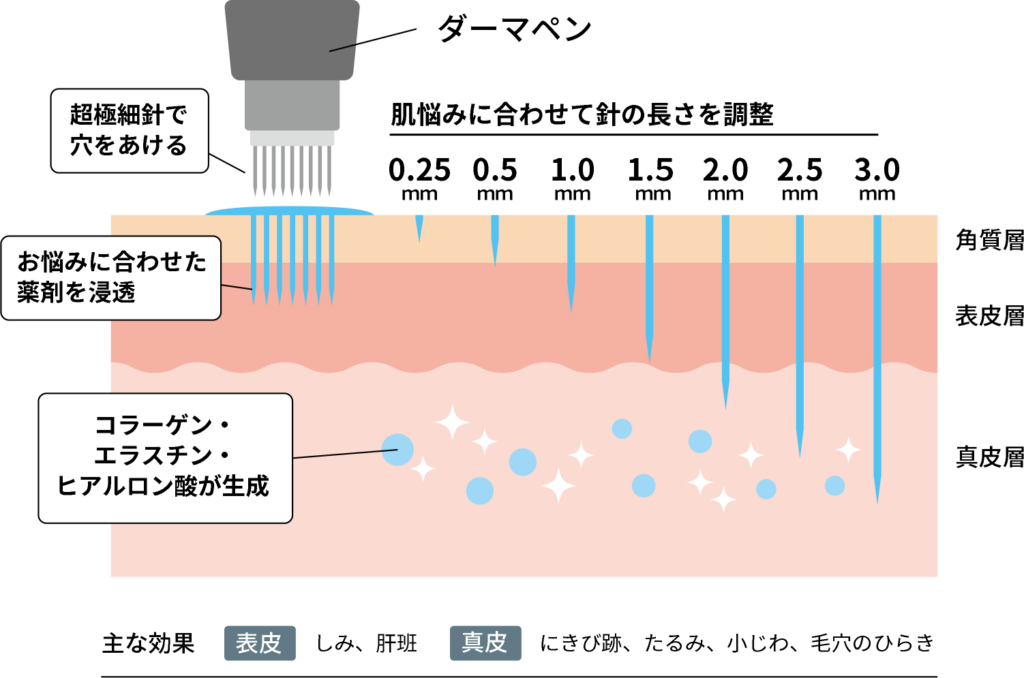 ダーマペンの効果のメカニズム