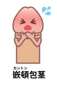 カントン包茎のイラスト