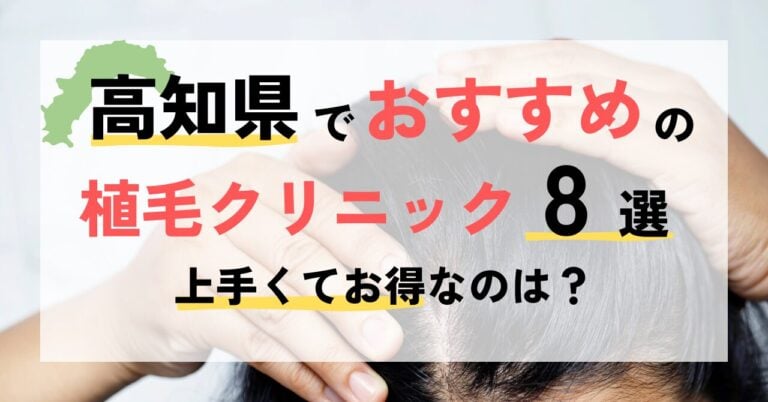 高知でおすすめの植毛クリニック8選！上手くてお得なのは？