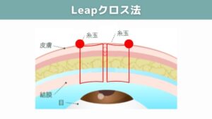 Leapクロス法の図