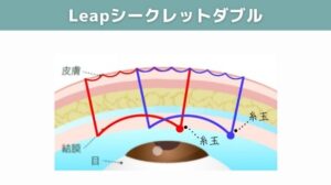 Leapシークレットダブルの図
