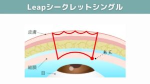 Leapシークレットシングルの図