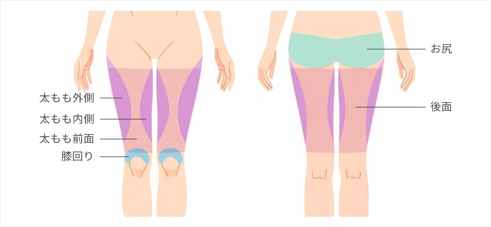 太もも及び周辺の施術可能な部位