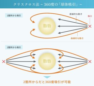 クリスクロス法のイメージイラスト