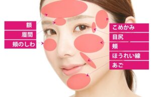 キュアジェットの顔の適応部位