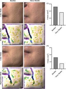 顔のたるみ・しわ改善に関する主要エビデンスの画像