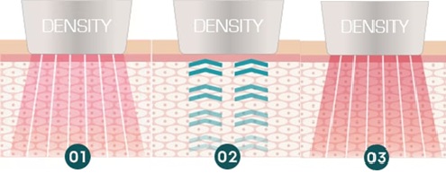 デンシティ独自のデュアルRF技術