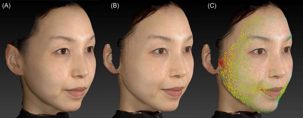 SUPERB™技術の応用研究(顔〜ボディ領域)の画像