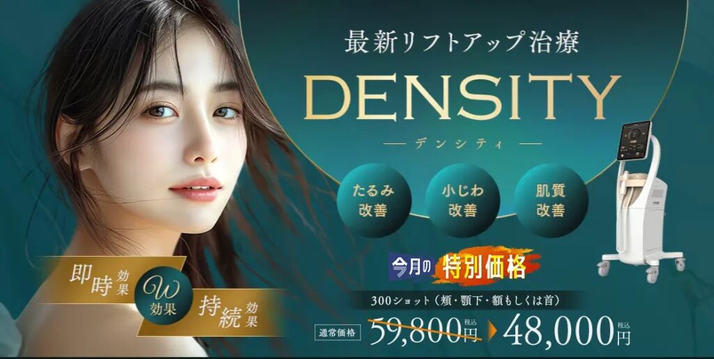 SBCのデンシティのバナー