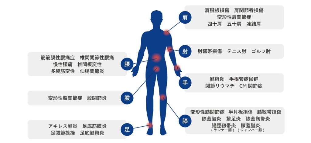 PDF-FD療法の適応部位