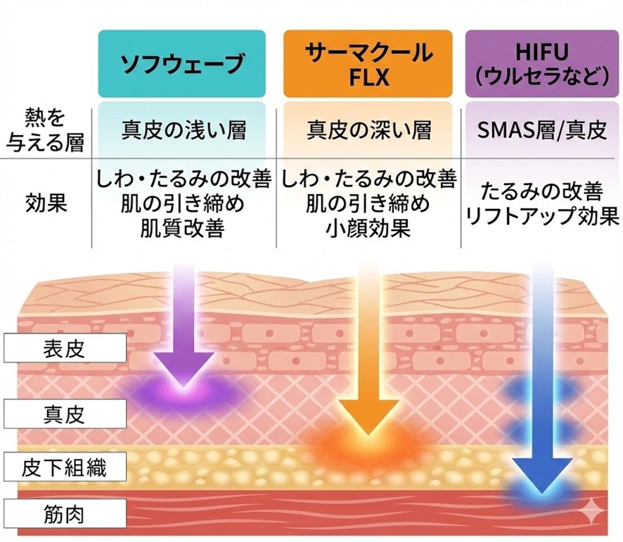ソフウェーブとサーマクール・ハイフとのアプローチ層の違い