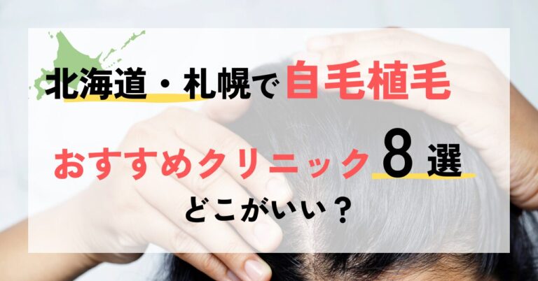 北海道・札幌でおすすめの植毛クリニック8選！どこが良い？