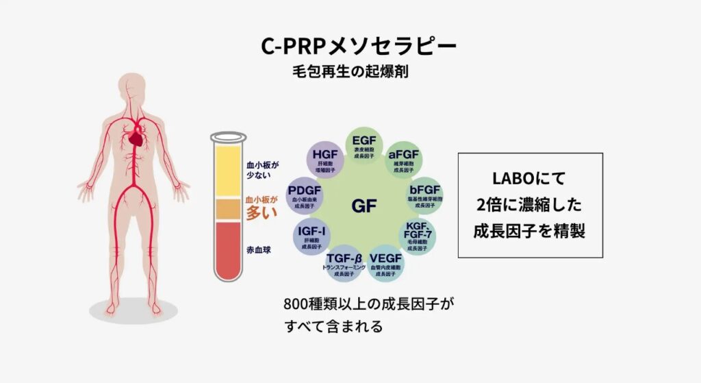 C-PRPメソセラピーに含まれる成長因子