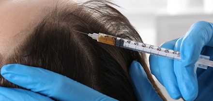 C-PRP注入の様子