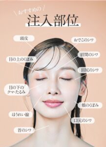 PDF-FD療法の注入部位