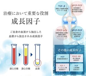 PDF-FD療法の成長因子の役割