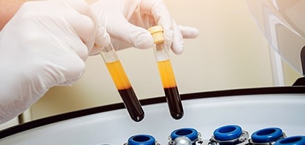 PDF-FD製剤へ加工