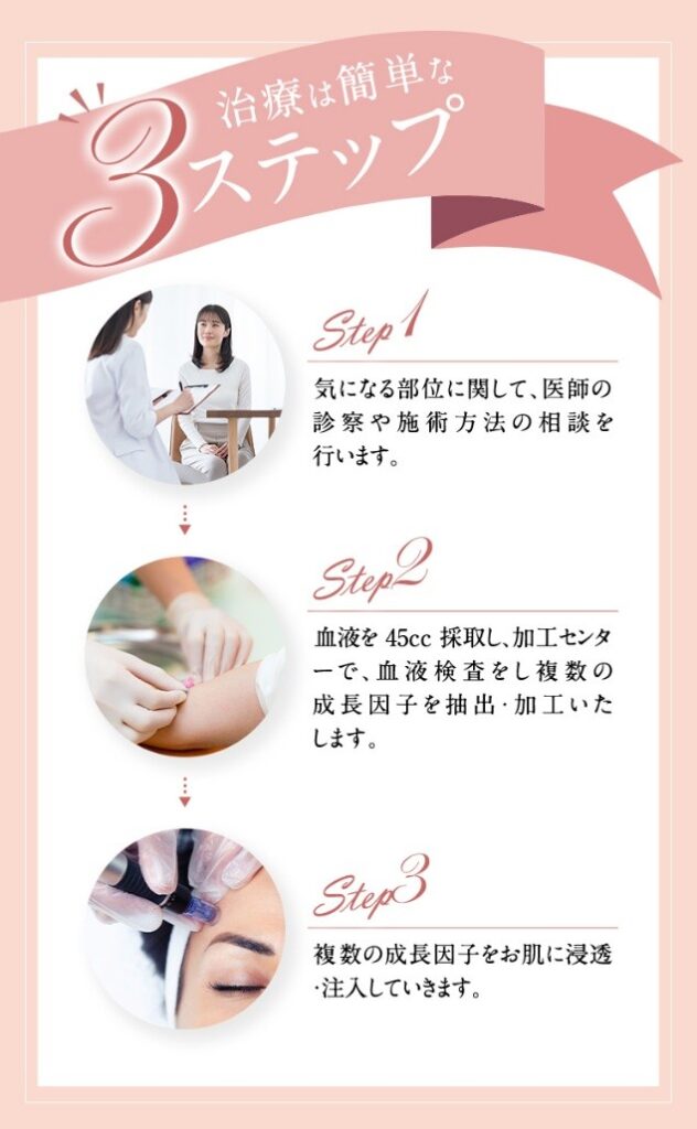 PDF-FD療法の流れ