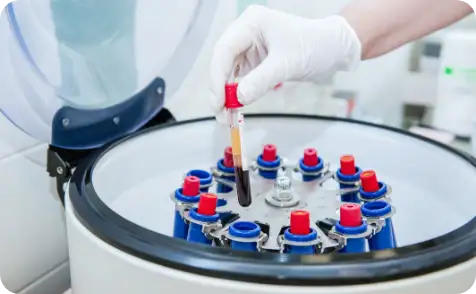 ゴリラクリニックの採血の様子